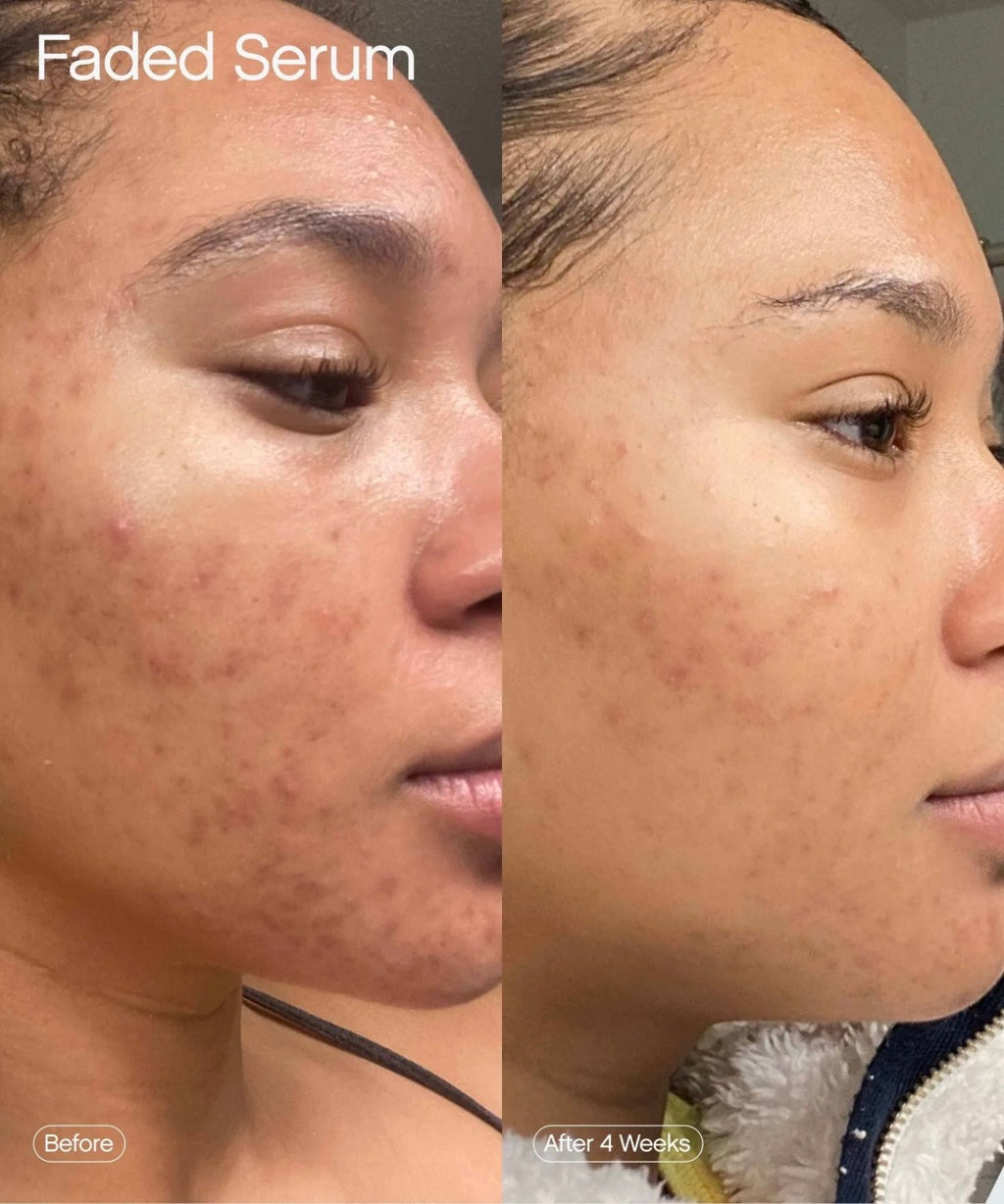 FADED Brightening Serum