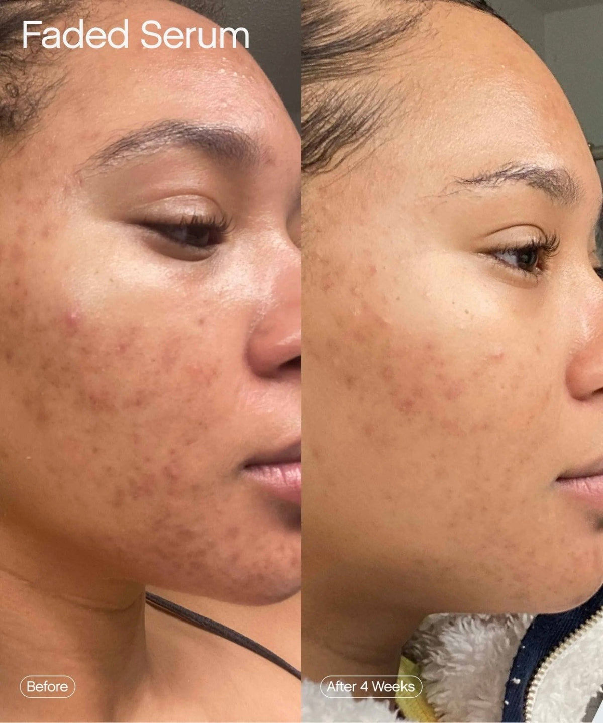 FADED Brightening Serum